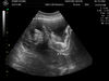 Filename=BABY_KOUNS_1.JPG
Filesize=97KB
Dimensions=640x480
Date added=Jun 19, 2006 BABY_KOUNS_1.JPG