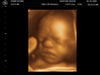 Filename=BABY_KOUNS_14.JPG
Filesize=58KB
Dimensions=640x480
Date added=Jun 19, 2006 BABY_KOUNS_14.JPG