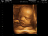 Filename=BABY_KOUNS_18.JPG
Filesize=59KB
Dimensions=640x480
Date added=Jun 19, 2006 BABY_KOUNS_18.JPG
