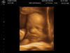 BABY_KOUNS_21.JPG