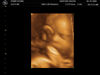 Filename=BABY_KOUNS_4.JPG
Filesize=54KB
Dimensions=640x480
Date added=Jun 19, 2006 BABY_KOUNS_4.JPG