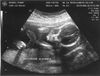 ultrasound3.jpg