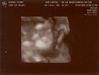 Filename=ultrasound4.jpg
Filesize=39KB
Dimensions=1113x839
Date added=Jun 17, 2006 ultrasound4.jpg